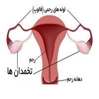 با 5 واقعیت جالب درباره تخمدان ها آشنا شوید