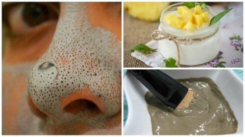 ماسکهای طبیعی برای خداحافظی با دانههای سر سیاه ماسکهای طبیعی برای خداحافظی با دانههای سر سیاه