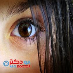 آب مروارید؛ علائم+2خوراکی مفید و  3خوراکی مضر
