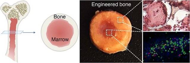 تولید استخوان زیست‌مهندسی شده برای پیوند مغز استخوان