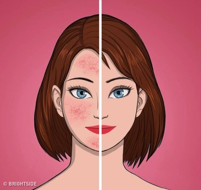 دلیل پیری پوست صورت 