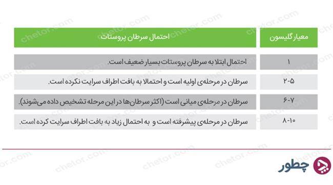 معیارهای سرطان پروستات