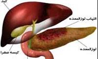 حقایق صفراوی