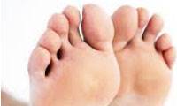 چگونه از پوست پاهایمان مراقبت کنیم؟