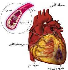 خطراتی که قلب انسان را هدف گرفته‌اند