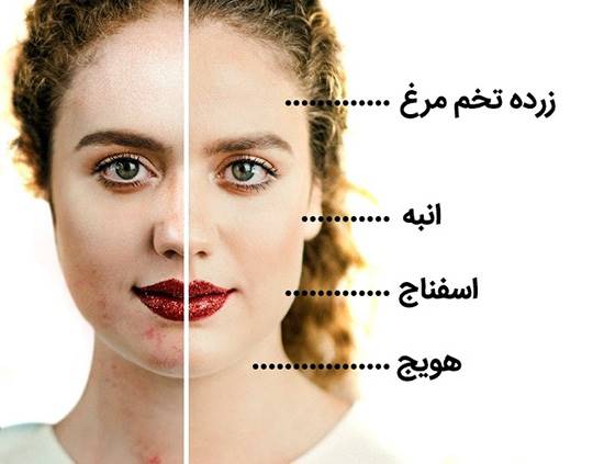 با این خوراکی ها، مشکلات پوستی را برطرف کنید