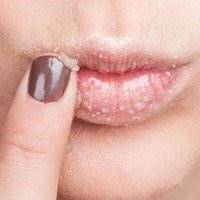 مراقبت از لب ها