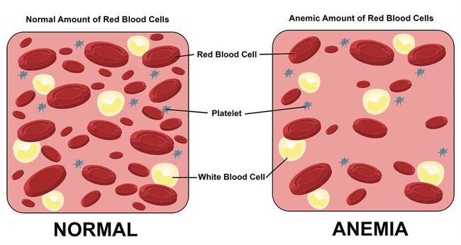 natural-remedies-for-anemia-during-pregnancy-mama-natural