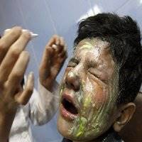 وقتی سوختگی کوچک‌ترین درد است
