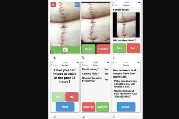 رصد عفونت زخم جراحی با یک اپلیکیشن