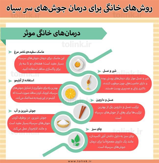 روش‌های خانگی برای درمان جوش سر سیاه