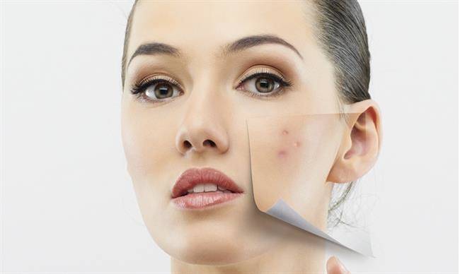 روش‌های طبیعی از بین بردن جای زخم، آکنه و جوش