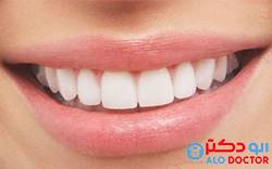 بهترین روش برای دندان از دست رفته