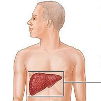 چگونگی تشخیص کبد چرب/ قبل از آزمایش، مایعات بنوشیم