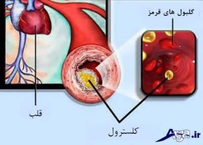 علایم چربی خون در بدن 