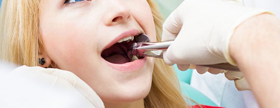 کشیدن دندان عقل موجب مرگ می شود؟