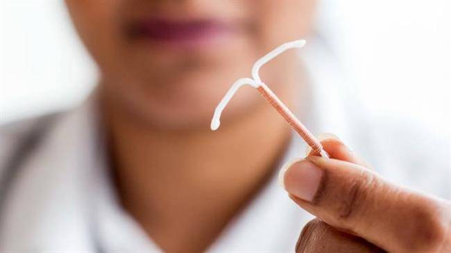 استفاده از IUD برای کاهش درد قاعدگی