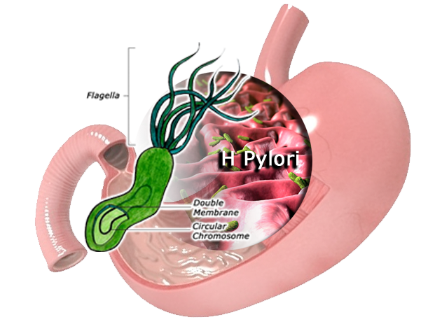 میکروب هلیکوباکتری معده 