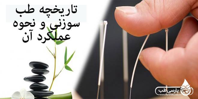 طب سوزنی: تاریخچه طب سوزنی و نحوه عملکرد آن در بدن