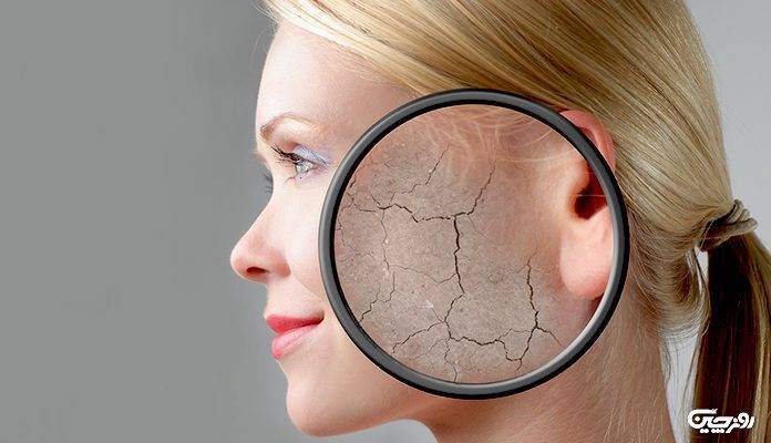 نحوۀ پاکسازی پوست خشک در خانه