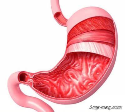 راه و رمز تقویت معده با روش های طبیعی