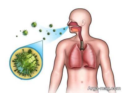 علایم عفونت ریه و روش های درمان آن 