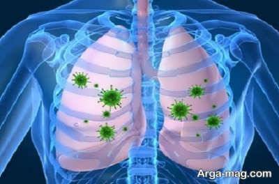 بهبود عفونت ریه