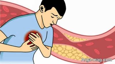 روش های پیشگیری از چربی خون بالا