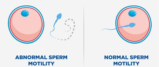 16 مورد در آزمایش اسپرم و تفسیر آنلاین آن