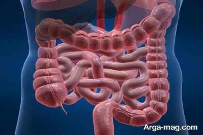 آشنایی با علایم عفونت روده