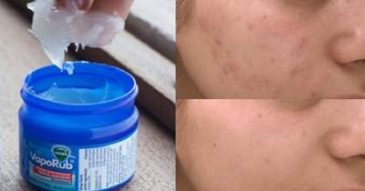  خواص پماد ویکس, ویژگی های پماد ویکس