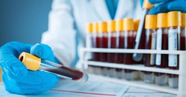 تجمیع پادتن‌های نجات یافتگان از کووید-19 برای توسعه درمانی جدید