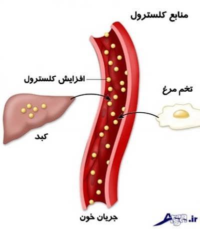 علامتهای چربی خون چیست