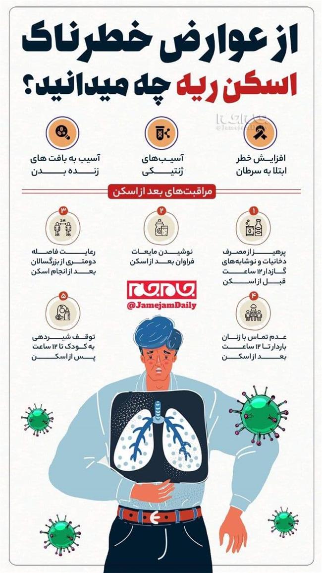 از عوارض خطرناک اسکن ریه چه می دانید؟