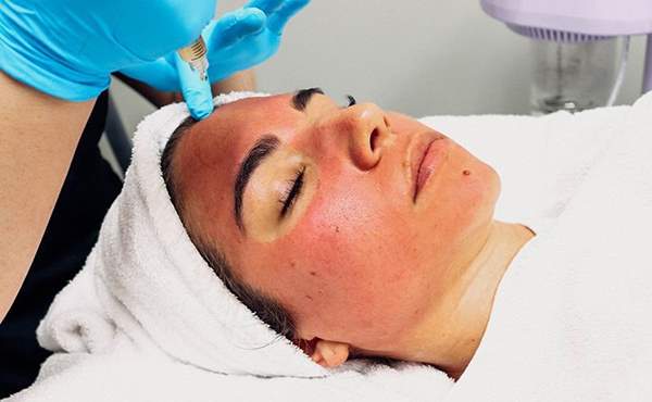 روشهای جوانسازی پوست؛ از لایه برداری تا کلاژن‌سازی