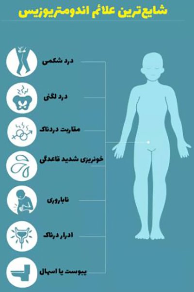 اندومتریوز و هرآنچه که باید درباره آن بدانید!