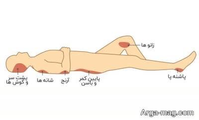 پیشگیری از زخم بستر