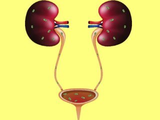 علائم عفونت ادراری و روش‌های درمان