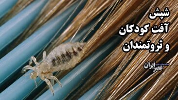 روش‌های درمان آستیگمات چشم کودکان (فیلم)