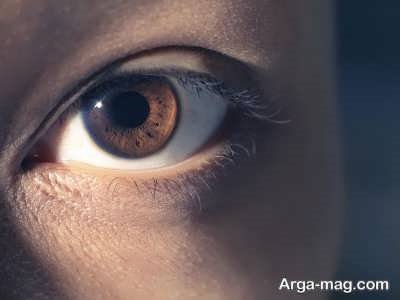چرا مردمک چشم بزرگ می شود؟