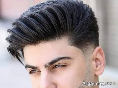 انواع پروتز مو