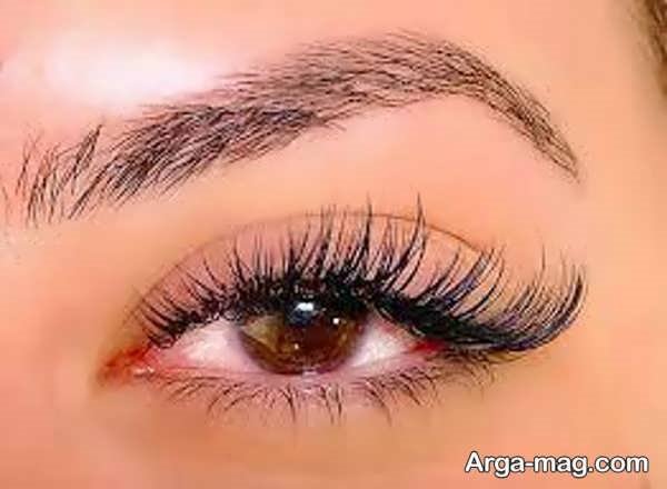 کاشت مژه کایلی