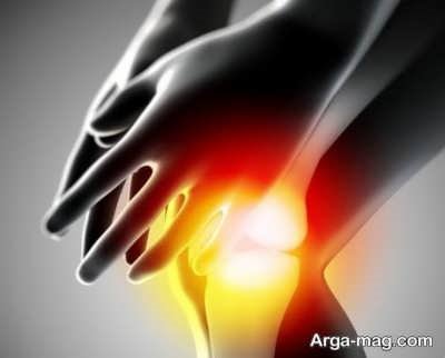 تکنیک هایی برای کنترل آرتروز