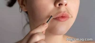 نشانه های اختلال پر مویی 