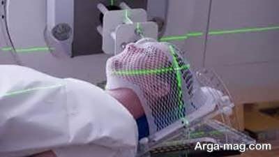 رادیوتراپی تومور مغزی
