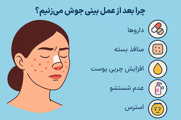 دلیل جوش زدن بعد از عمل بینی