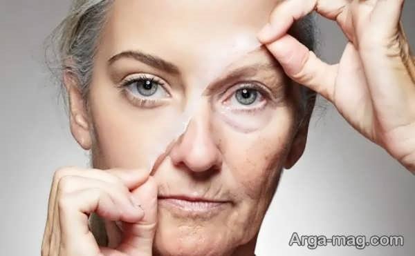 مزیت های کرم لیفتینگ