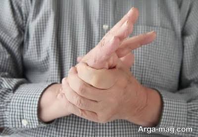 دلیل بی حسی دست