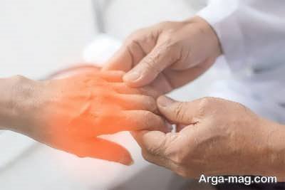 کمبود مواد مغذی در بدن علتی برای بی حس شدن دست ها 