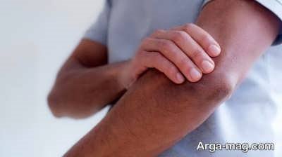 سندروم رینود و بی حس شدن دست ها 
